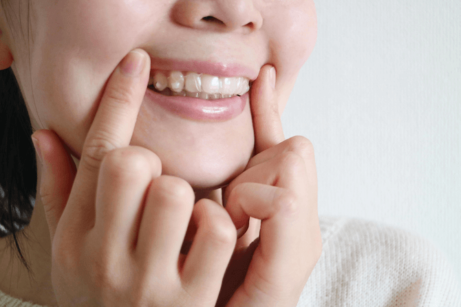 歯列矯正のゴムかけの効果とは？メリットやデメリットを紹介