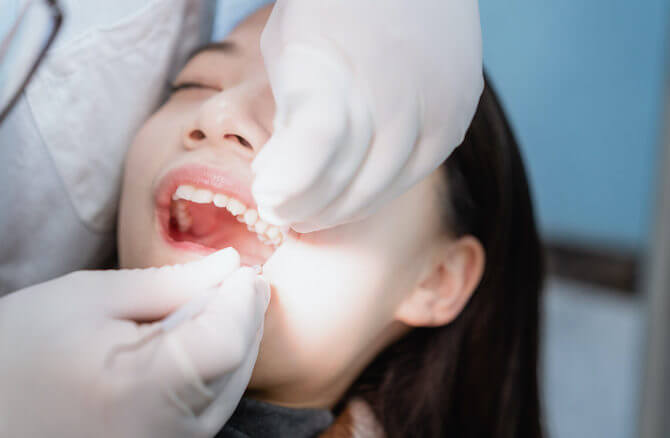 歯列矯正で抜歯を後悔する4つの理由|抜歯が必要なケースとは？